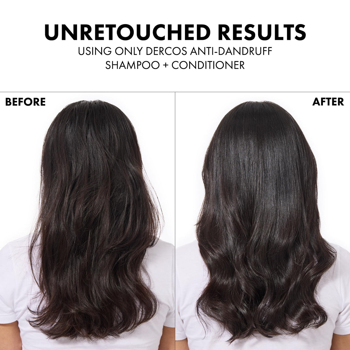 Vichy Dercos Anti-Hair Loss Shampoo with Aminexil - Strengthening, 6.76 fl oz